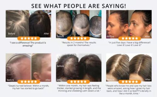 Mesmerizing Essynaturals Hair Growth Oil Design Photography Mesmerizing Essynaturals Hair Growth Oil Design Photography